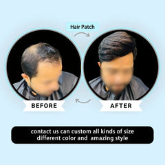 Australia Base Human Hair Toupee for Men Patch Natural Black French Lace Thin Skin Pu Male Wig's Hairpiece System Prosthesis