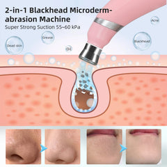 Portable Diamond Peeling Machine Microdermabrasion Facial Cleaning Device Exfoliation Vacuum Blackhead Remover