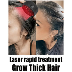 Laser Massager Hair Growing Cap Anti-hair loss Strengthen hair roots Deepen hair follicles Promote regeneration Dry Damaged Frizzy Hair