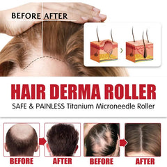 Natural Hair Beard Growth Derma Micro Dermaroller Hair Regrowth Anti Hair Loss Men Hair Growth Products