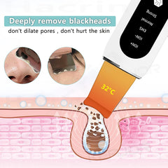 Deep Face Cleaning Ultrasonic Cleaner Ultrasonic Skin Scrubber Blackhead Remover Shovel Facial Peeling Cleaning Acne 26000hz