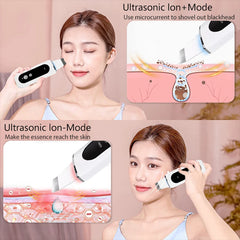 Deep Face Cleaning Ultrasonic Cleaner Ultrasonic Skin Scrubber Blackhead Remover Shovel Facial Peeling Cleaning Acne 26000hz