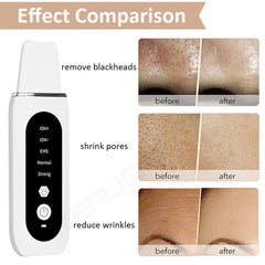 Deep Face Cleaning Ultrasonic Cleaner Ultrasonic Skin Scrubber Blackhead Remover Shovel Facial Peeling Cleaning Acne 26000hz