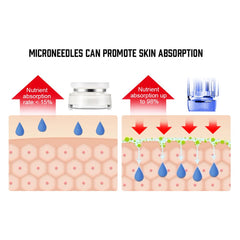 Microneedling microneedling at home Cartridge  Microneedles Derma Pen Mesotherapy needle - Bellelooks